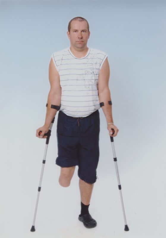 Wojciech Os potrzebuje wsparcia w modernizacji protezy nogi.